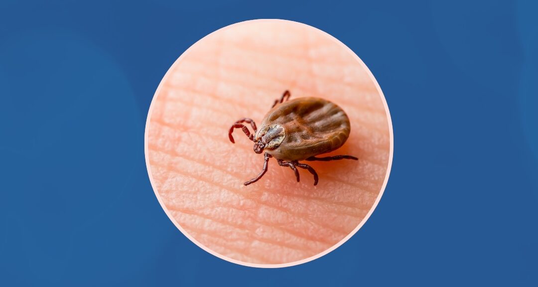 Webinaire «Lyme et tiques» | Série Zoonoses & changements climatiques – INSPQ
