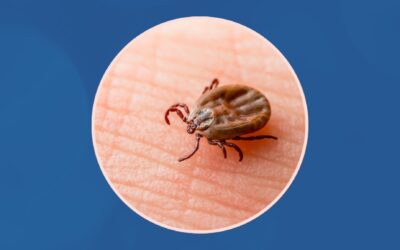 Webinaire «Lyme et tiques» | Série Zoonoses & changements climatiques – INSPQ
