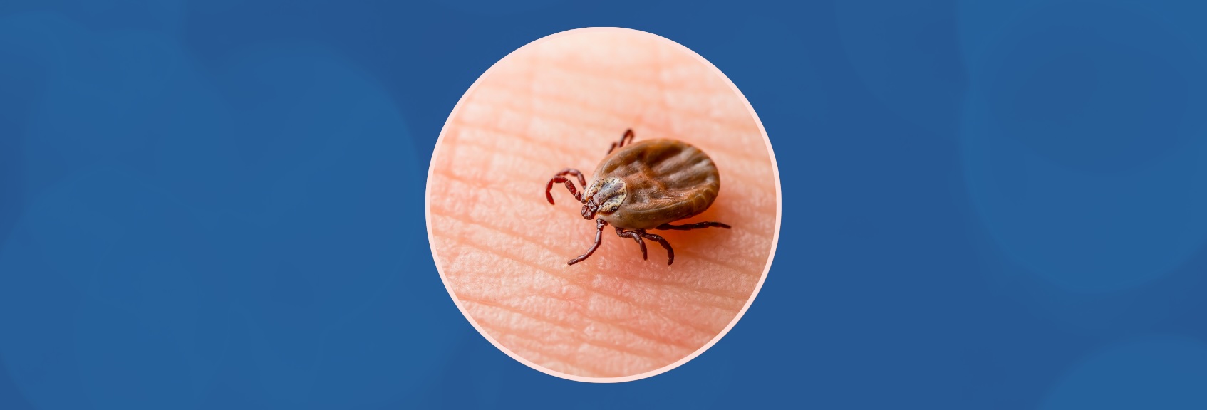 Webinaire | Évolution de la zone d’endémicité de la maladie de Lyme au Québec